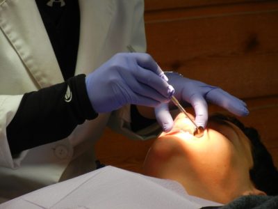 Amalgames dentaires